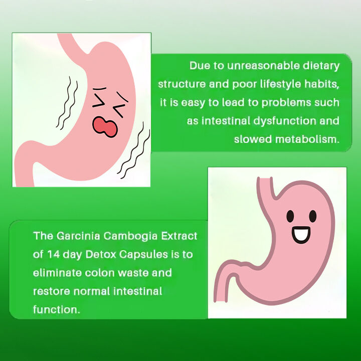 OEM ODM 14 Günlük Zayıflama Kapsülü Hızlı Etki Eden İştah Kesici ve Yağ Yakıcı Haplar Yetişkinler İçin Diyetsel Lif